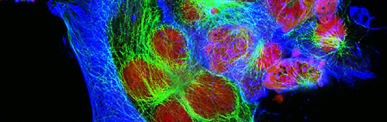 human neuroblastoma cells
